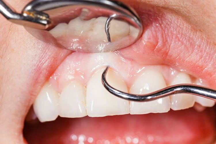 periodonto